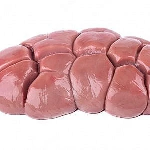 Kidney